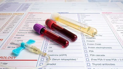 Infection Marker Analysis